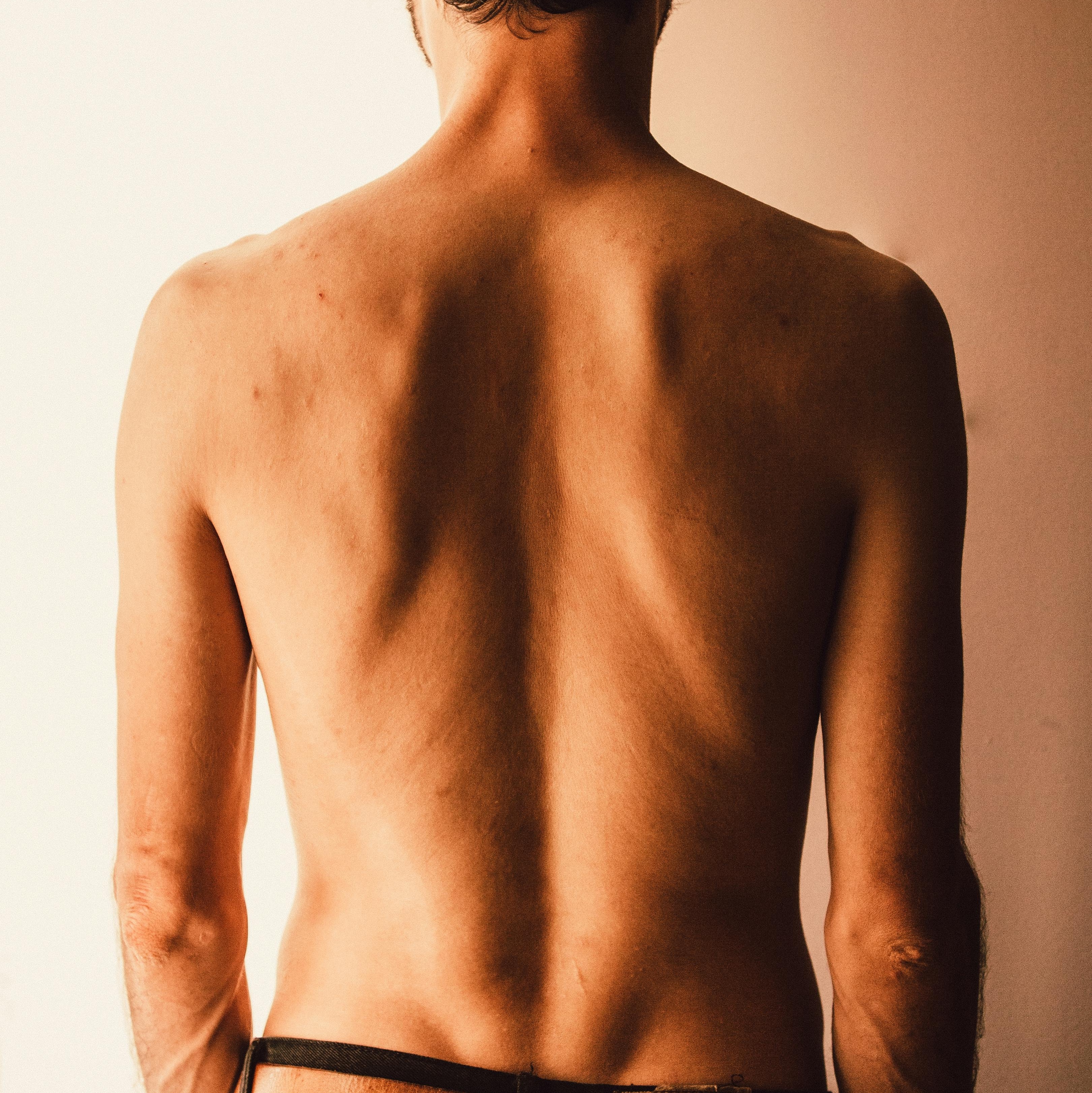 Das hilft gegen Pickel am Rücken Frau mit Rückenansicht, die sich mit beiden Händen über die Schultern streckt, während sie in einem weißen Badetuch vor einem Spiegel steht.