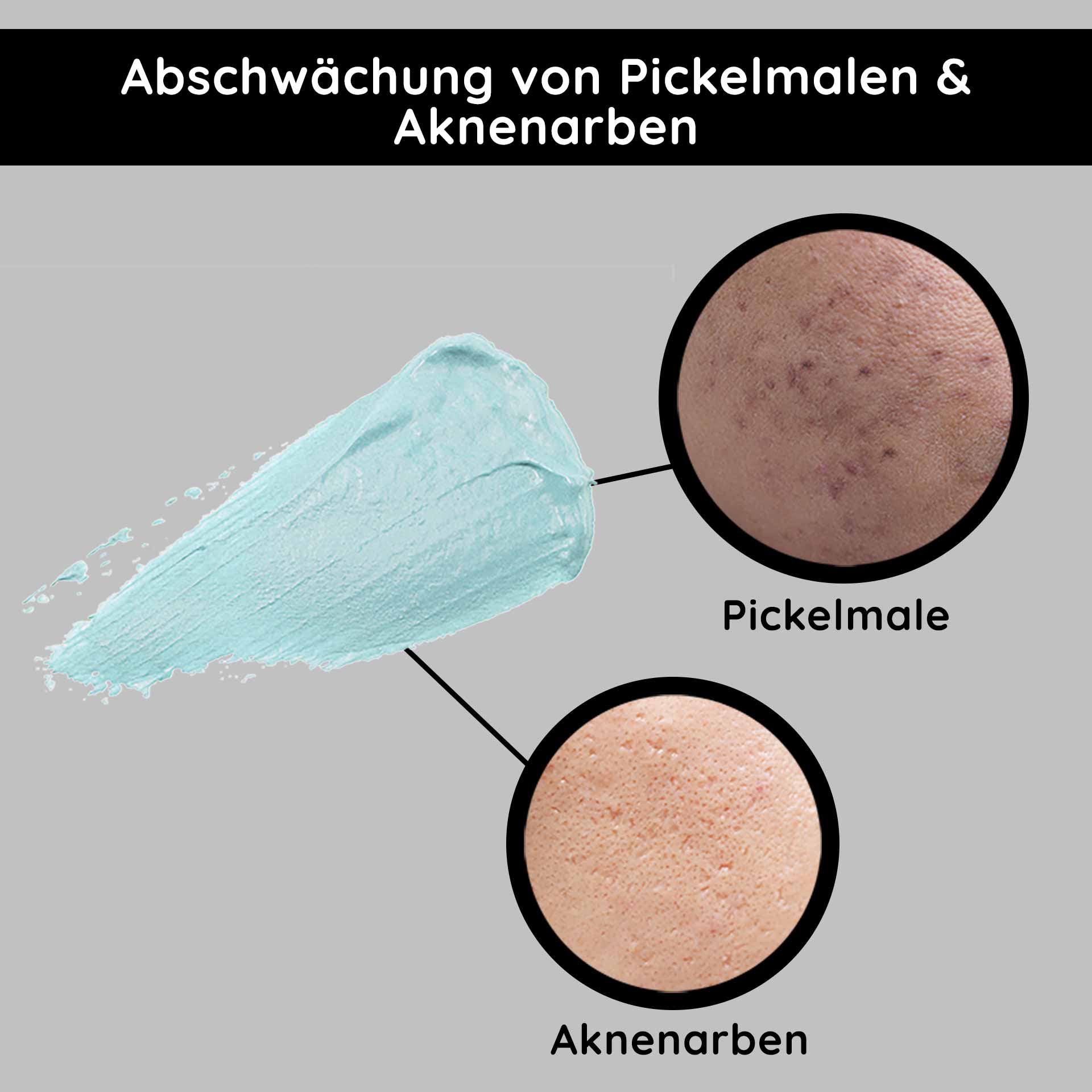 O2 Rich Cream 200 мл Богатый и ароматный крем Abschwächung von Pickelmalen und Aknenarben mit blauer Creme, Vergleich von Hauttexturen für Hautpflegeprodukte.