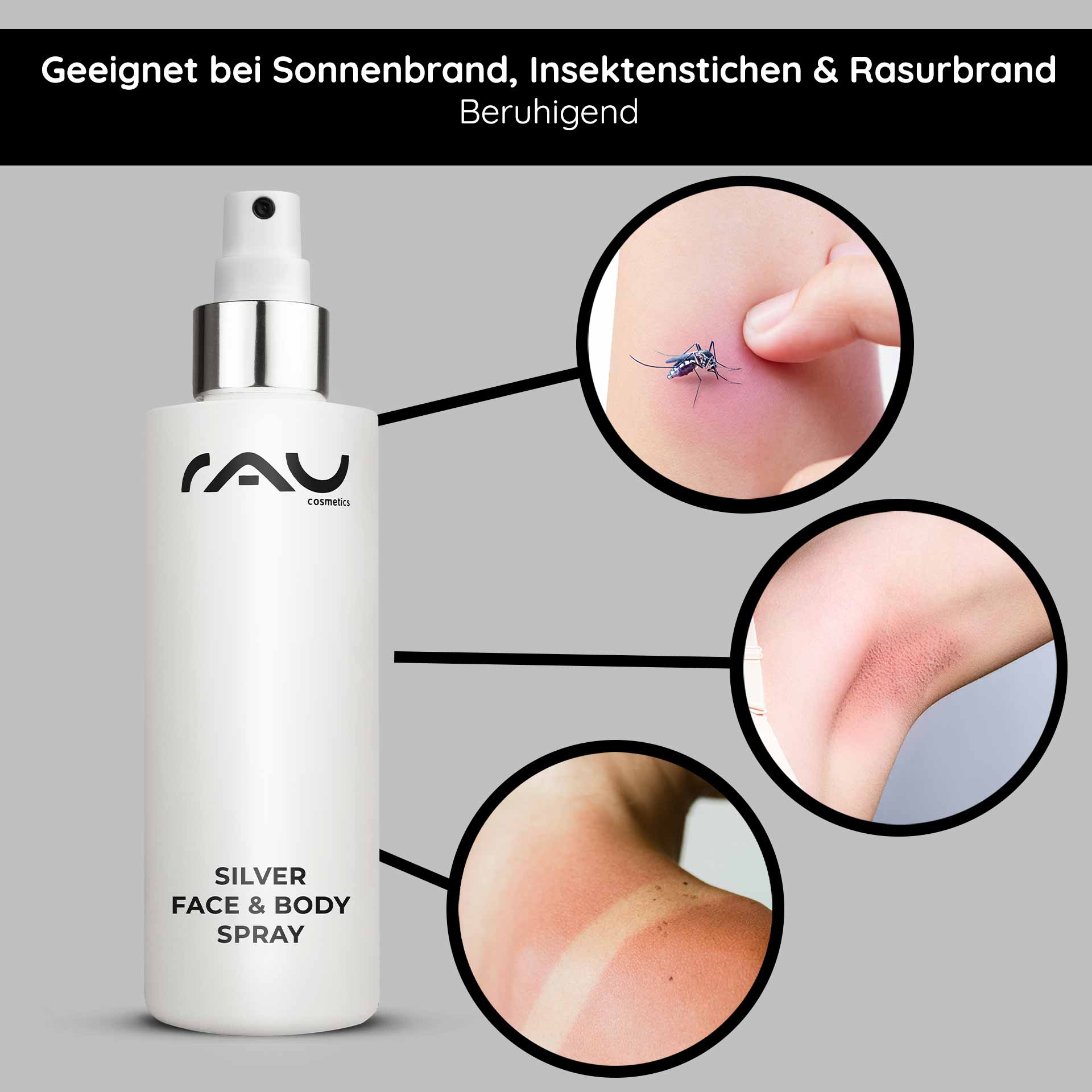Silver Face & Body Spray von RAU Cosmetics, geeignet zur Linderung von Sonnenbrand, Insektenstichen und Rasurbrand, mit sichtbaren Beispielen für Hautirritationen und einem eleganten Sprühflaschendesign.